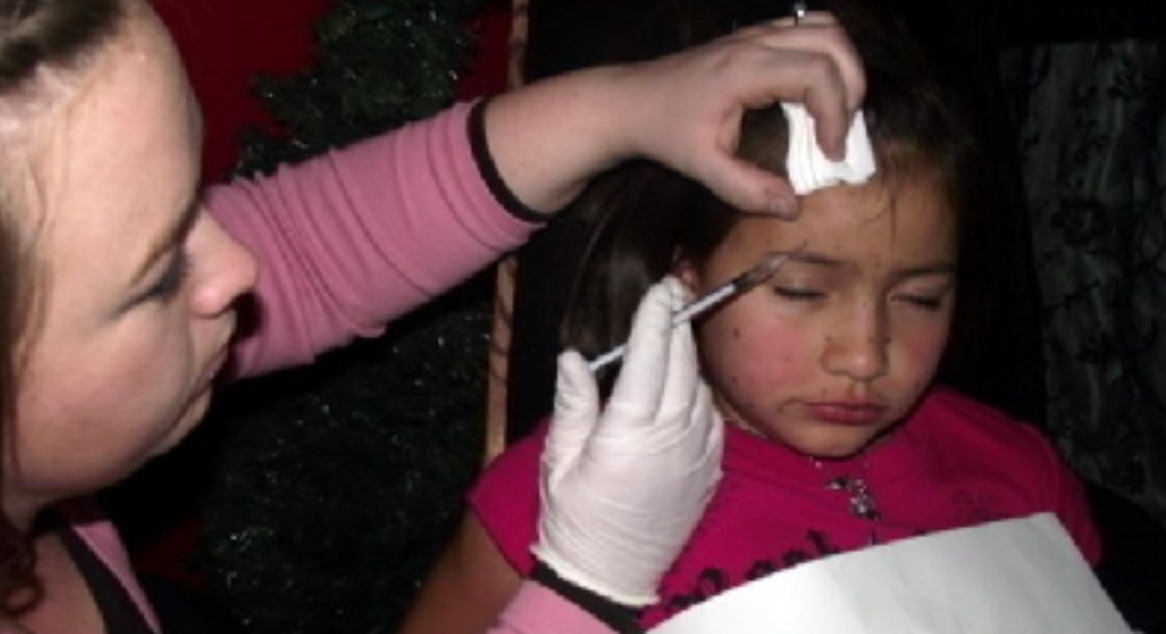 How To Make Botox Last Longer: 8 Doctors on Prolonging Botox & Filler