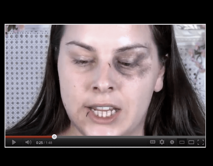 "Toe-besity": The Latest Kind of Fat That Women Are Worrying About