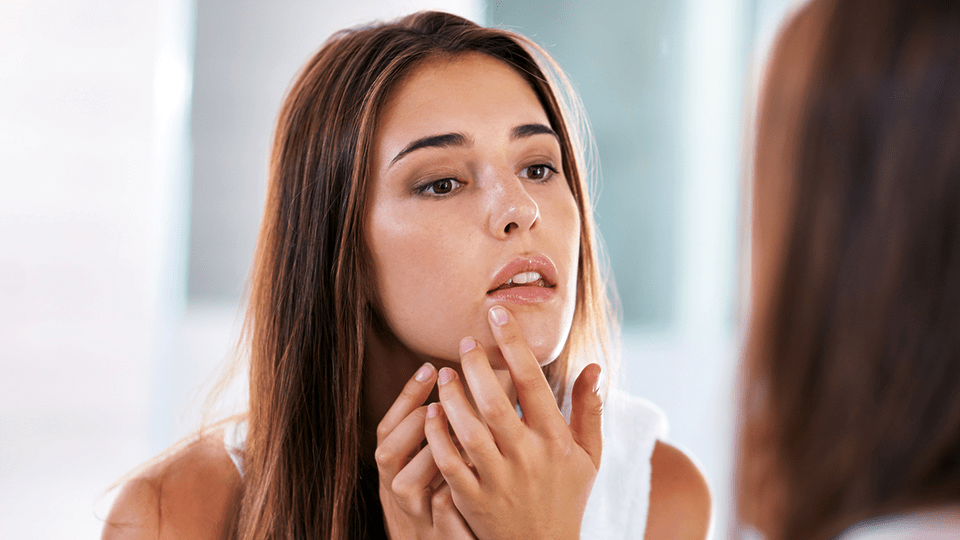 7 Tried-and-True Moisturizers That Won't Break You Out