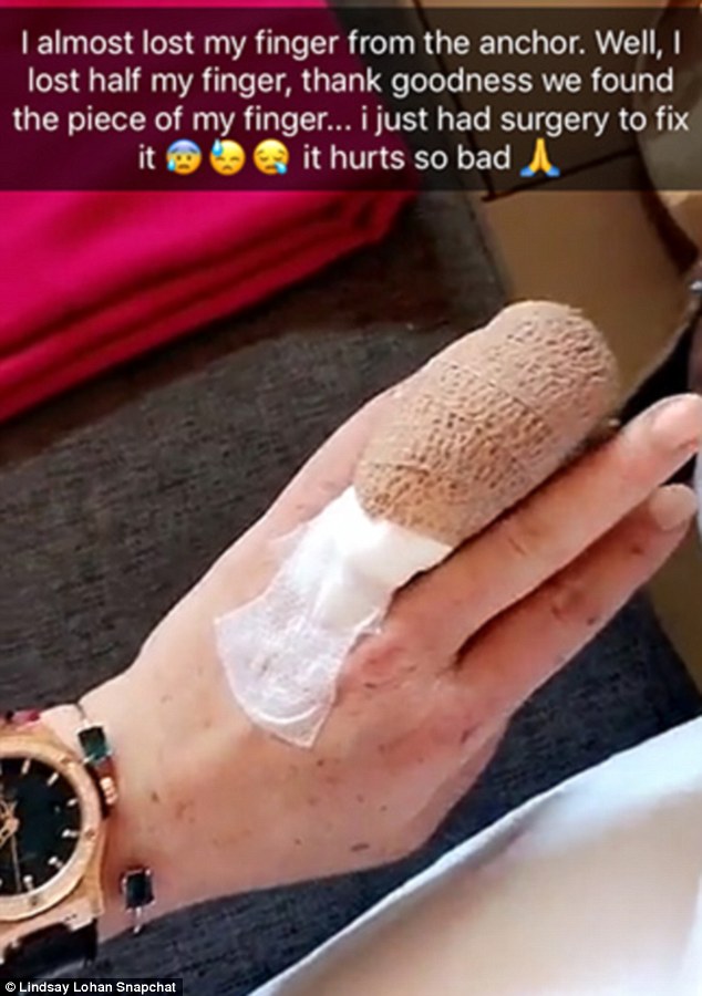 3909dce700000578-3818633-_i_lost_half_my_finger_the_mean_girls_star_30_had_attempted_to_l-a-97_1475439175450