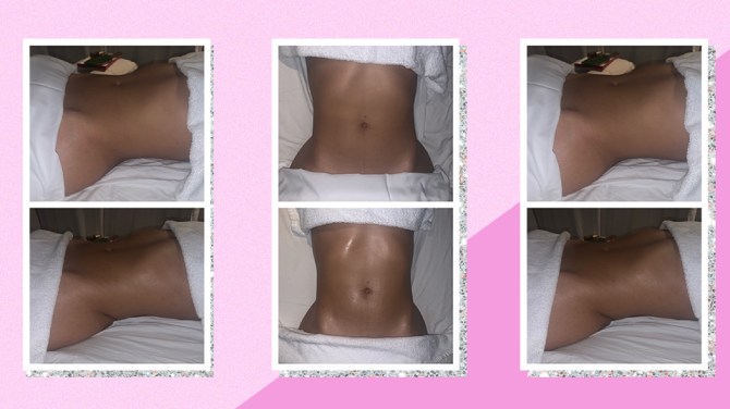 lymphatic drainage massage before and after