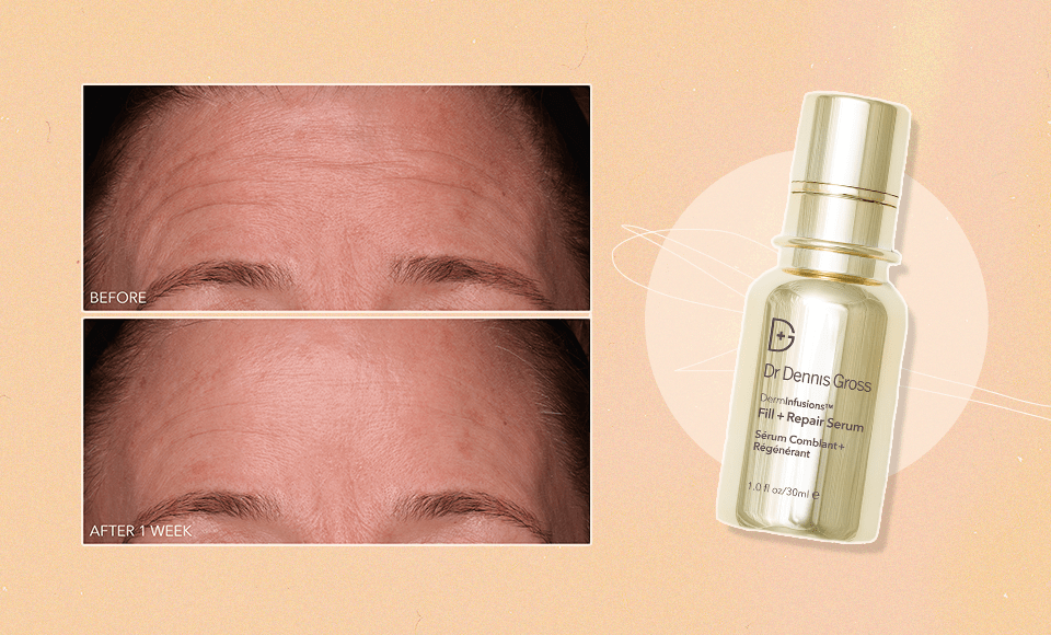 dr. dennis gross serum