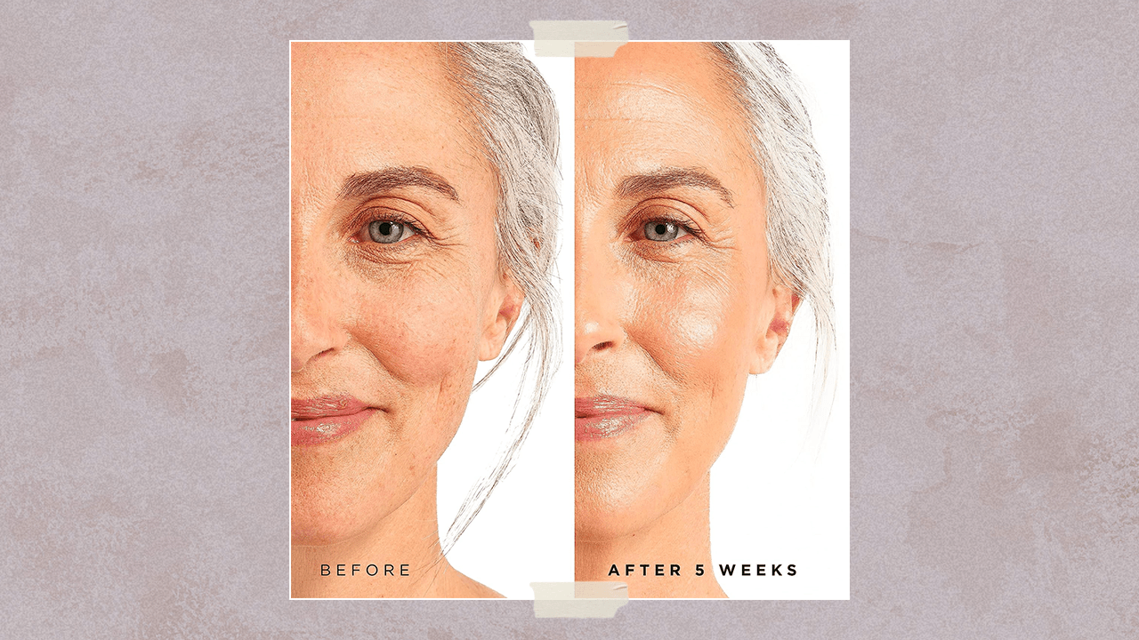 Tree of Life Retinol Serum Results Before and After 5 Weeks of Use